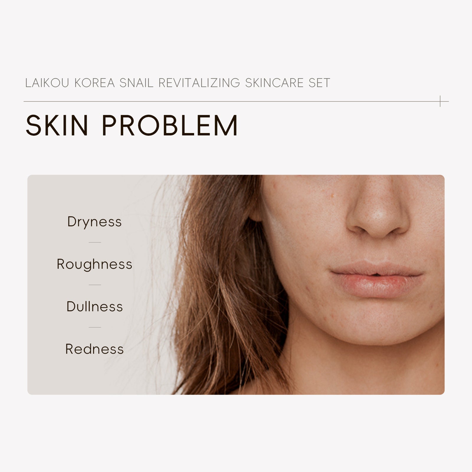 Snail Skincare Five-Piece Set